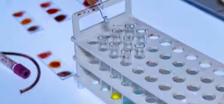 संक्रमित रक्त चढ़ाने के प्रकरण में कड़ी कार्रवाई, ब्लड बैंक प्रभारी डॉक्टर और लैब टेक्निशियन निलंबित